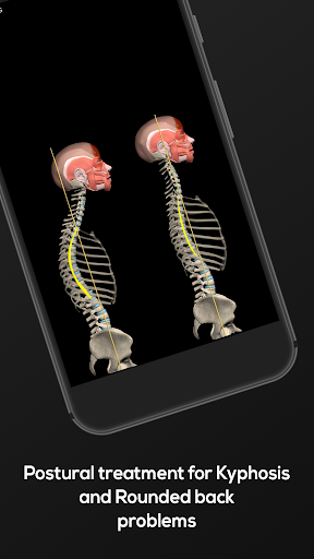 M&M компаниясының кифозы және артқы жағын дөңгелектеу;;Сізге өзіңіздің тым ақырын көзқарасыңыз ұнамайды